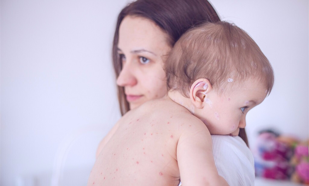 没螨才是新晋宝妈亲子生活的风向标