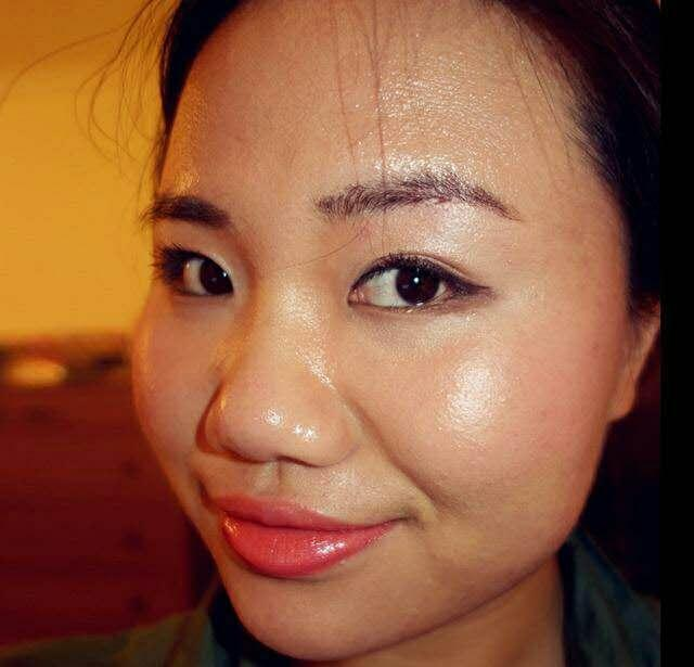 皮肤显露的小白囊是什么?脸上有这3种情况,